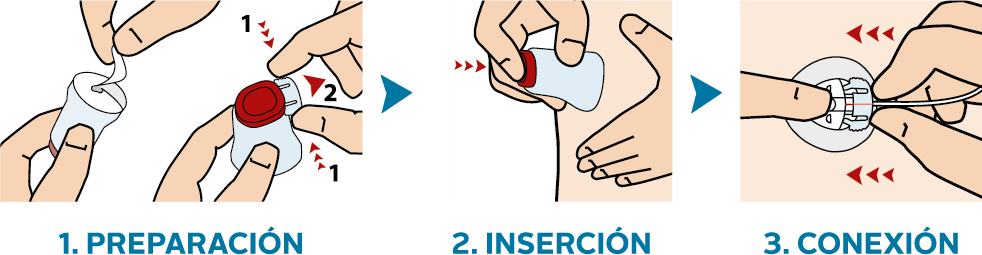 Tres pasos de uso de Neria Guard: 1. Preparación, 2. Inserción, 3. Conexión.